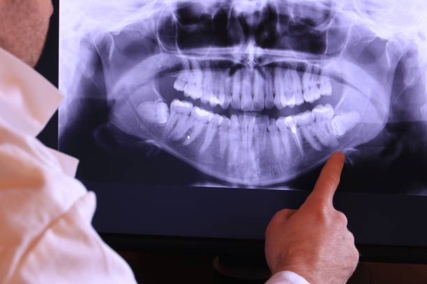 Best Broken or Chipped Tooth Repair in King Cove, AK